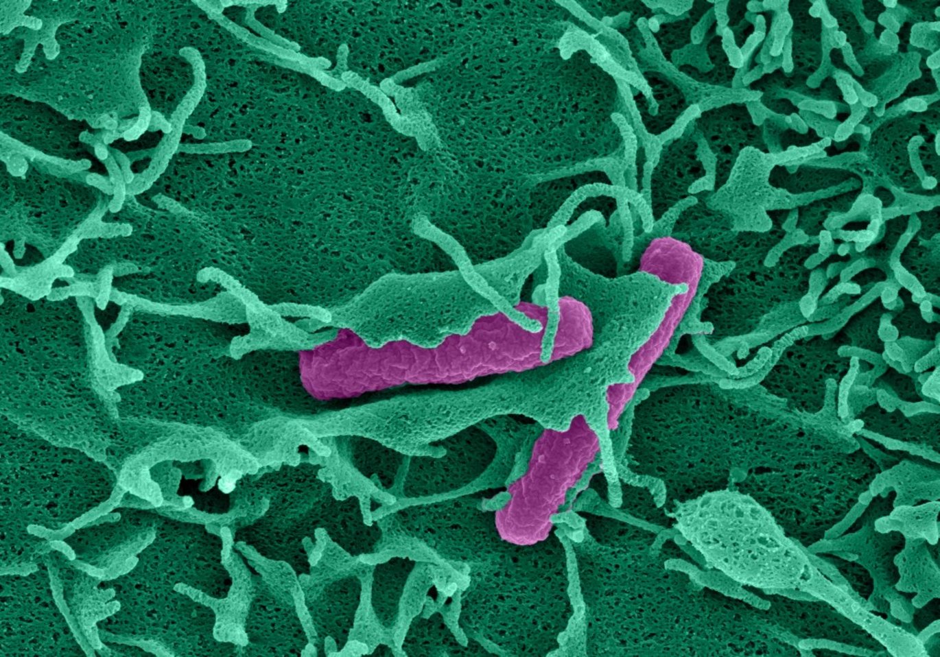 an electron micrograph of a cell membrane ruffling around a bacterial cell